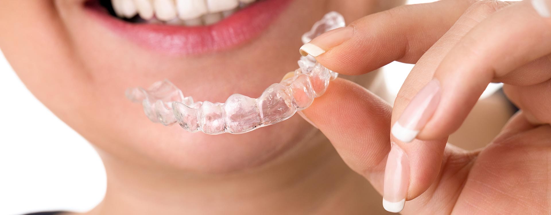 ZahnZoo Krefeld | Unsichtbare Zahnspangen ZahnZoo Krefeld|Unsichtbare Zahnspangen