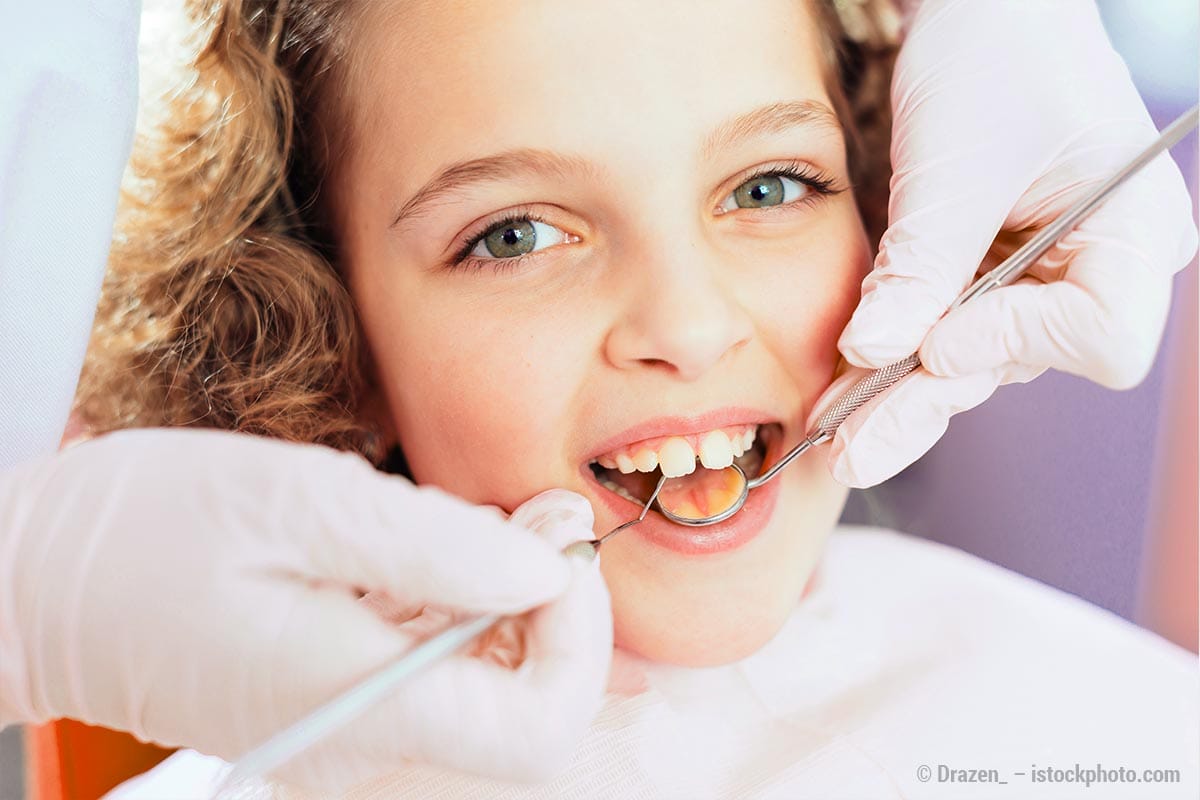 ZahnZoo Krefeld | Die Fissurenversiegelung: Wirksamer Karies-Schutz für junge Backenzähne!