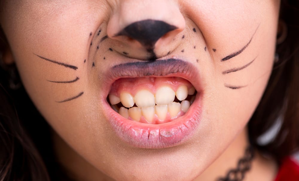 ZahnZoo Krefeld | Zähneknirschen bei Kindern – Ursachen und Behandlungsmöglichkeiten